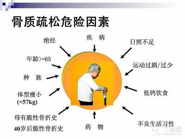 长期使用激素会导致骨质疏松症?保养骨头要避免这些误区